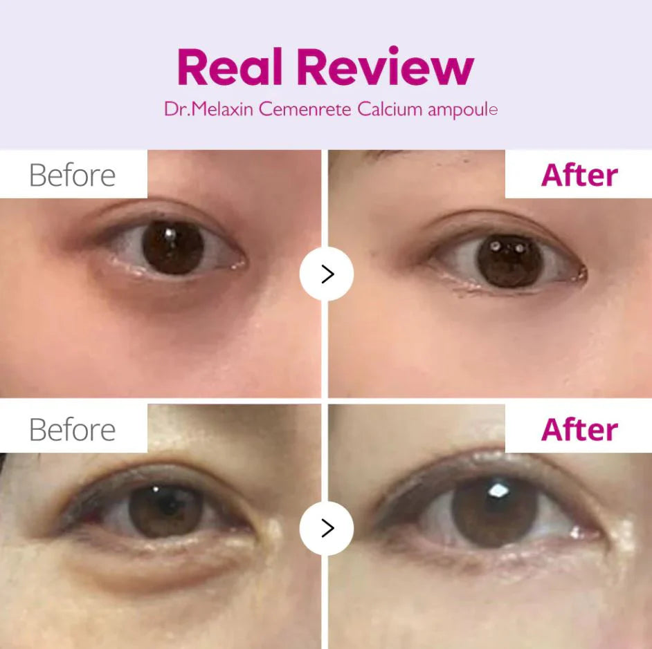 Cemenrete Calcium Intense Ampoule Plus