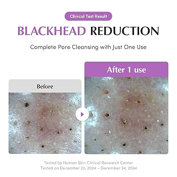 Purple Rice Pore Purifying Pack Cleanser