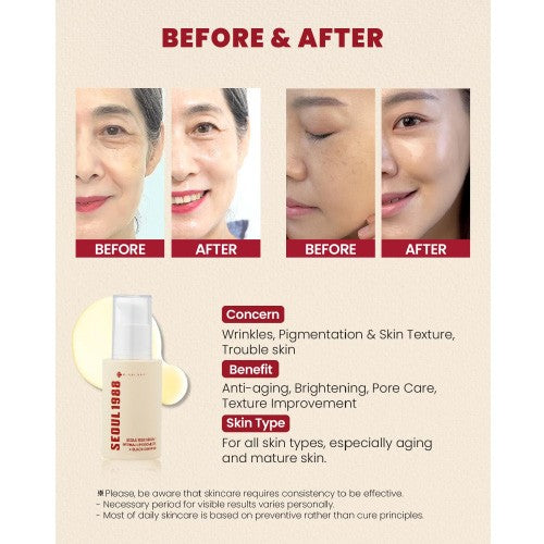 SEOUL 1988 Cream: Retinal Liposome 1% + Fermented Rice