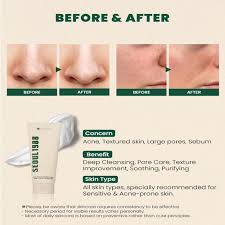 SEOUL 1988 Cleansing Foam: Pine Cica 1% + Probiotics