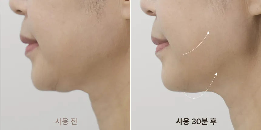Line Lifting Hydrogel Jawline Patch