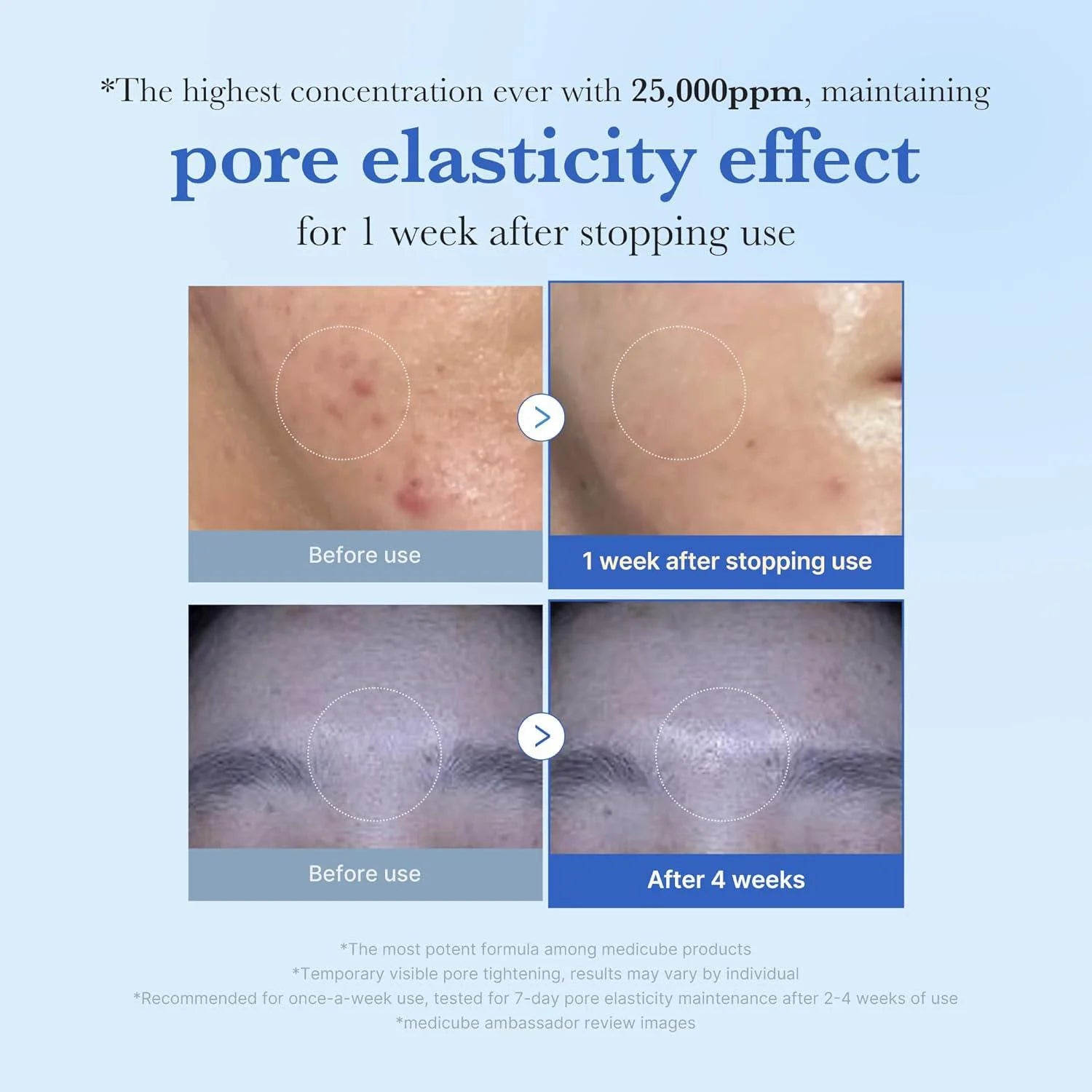 One Day Exosome Shot Pore Ampoule 25000