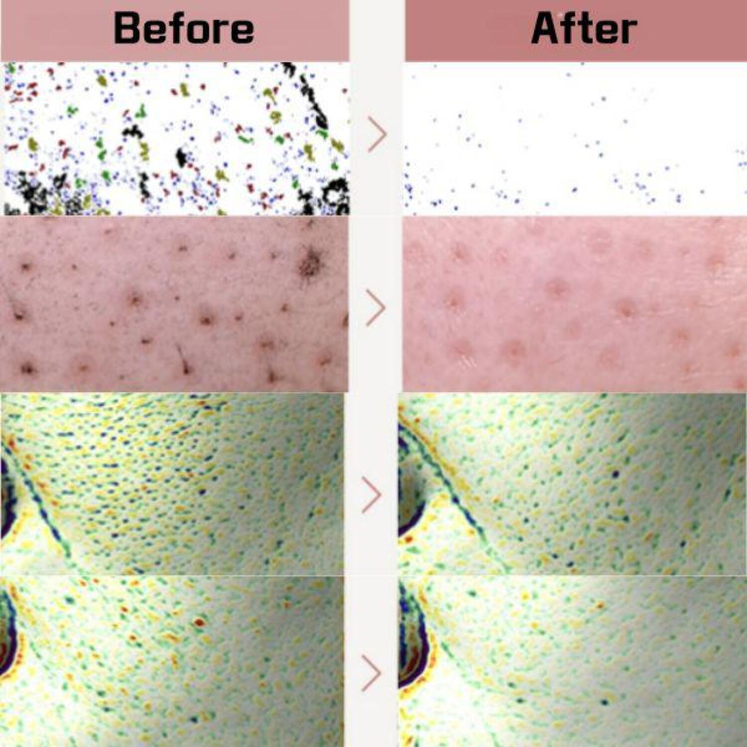 Red Bean Retinol Pore Peel To Foam