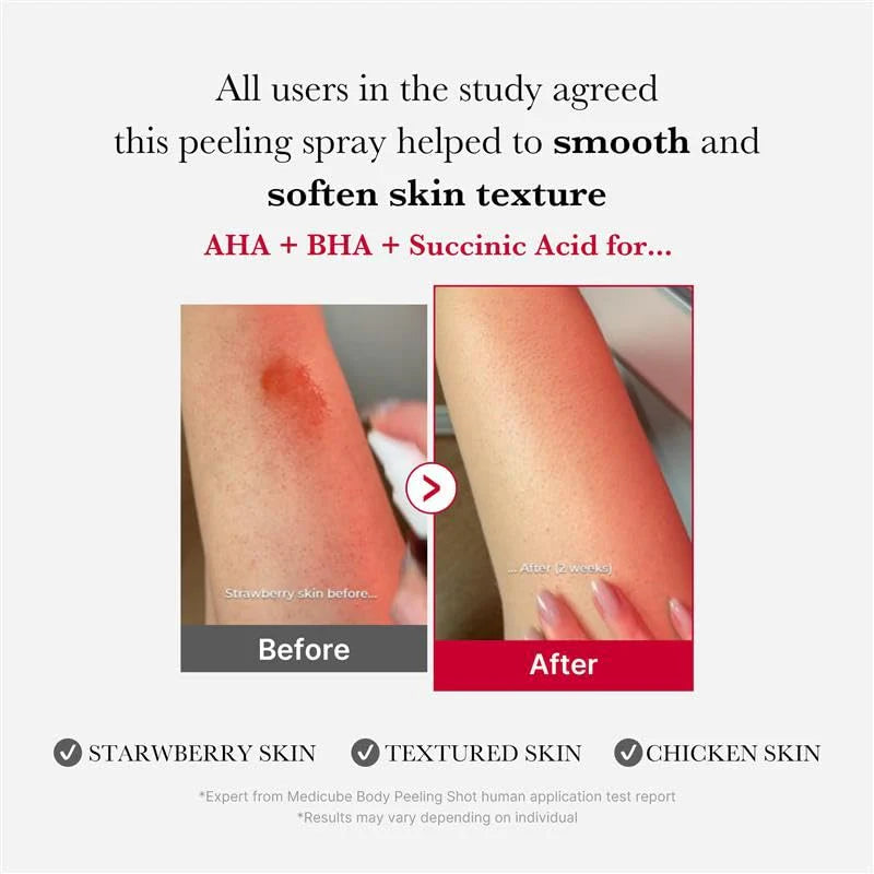 Red Acne Body Peeling Shot