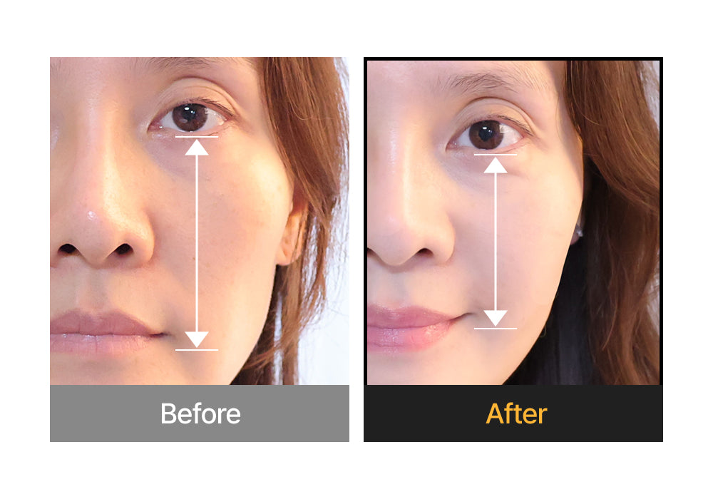 Silk Peptide Intensive Lifting Cream