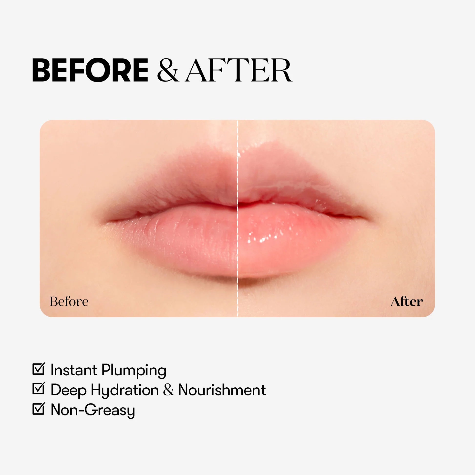 Reedle Shot Lip Plumper Expert