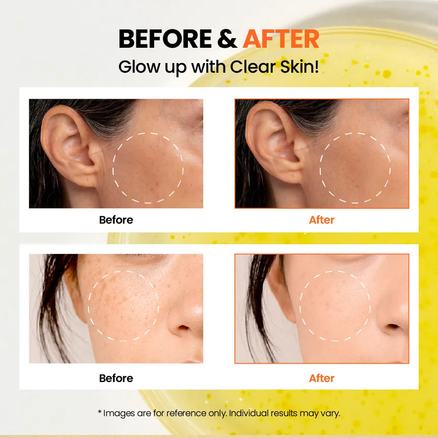 SEOUL 1988 Glow Serum: Niacinamide 15% + Yuja