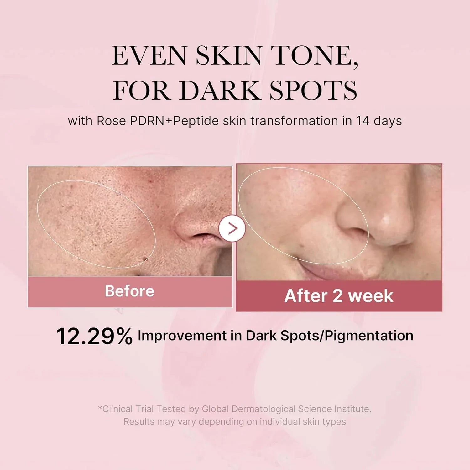 PDRN Pink Niacinamide Milky Toner