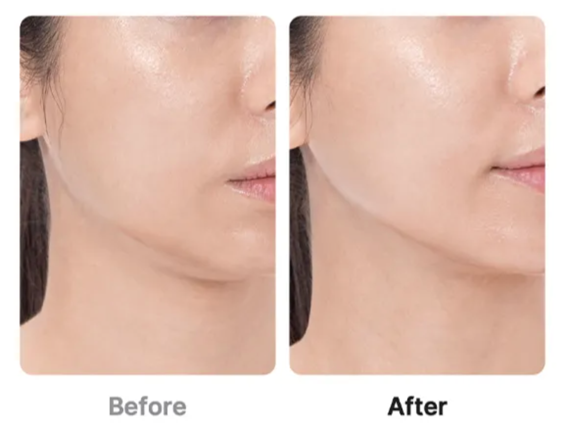 Age-R Booster Pro Glow Set