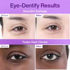 No.9 NAD Under Eye Patches