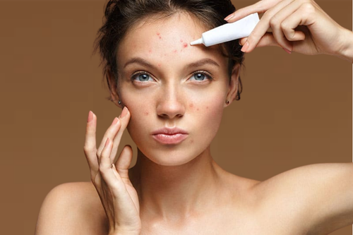 Korean Skincare for Problem Skin