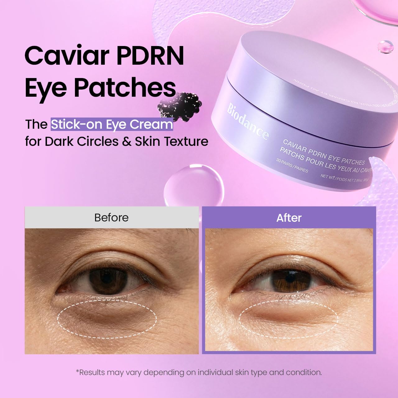 Caviar PDRN Eye Patches [30ea]