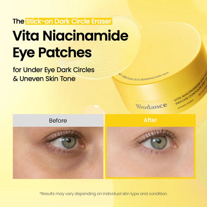 Vita Niacinamide Eye Patches