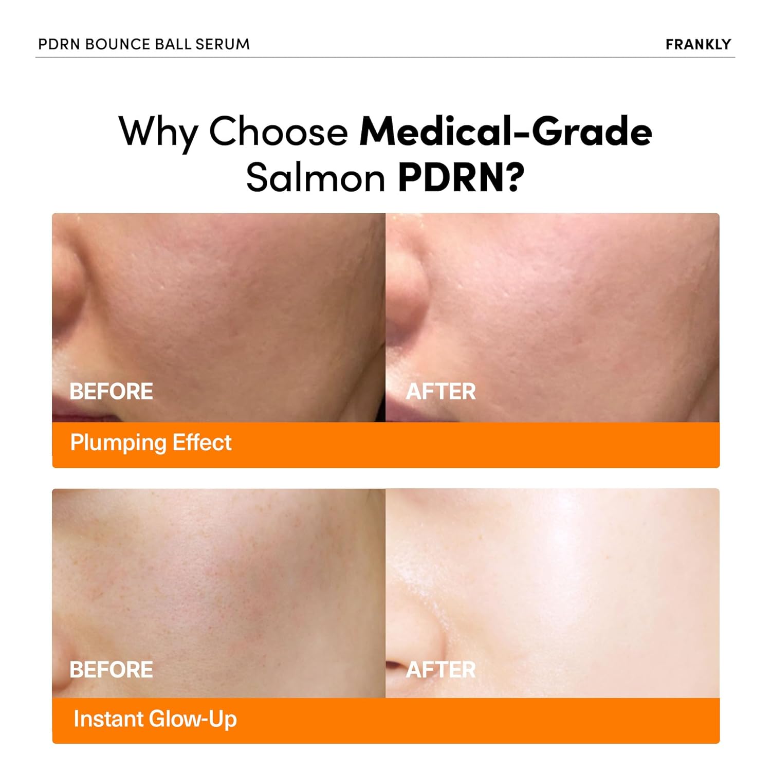 PDRN Bounce Ball Serum [30ml]