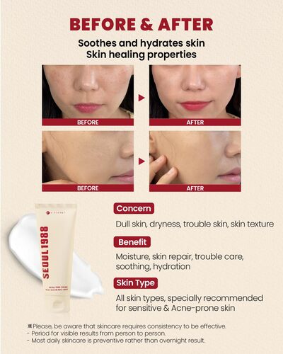 SEOUL 1988 Crème : Mucine d&