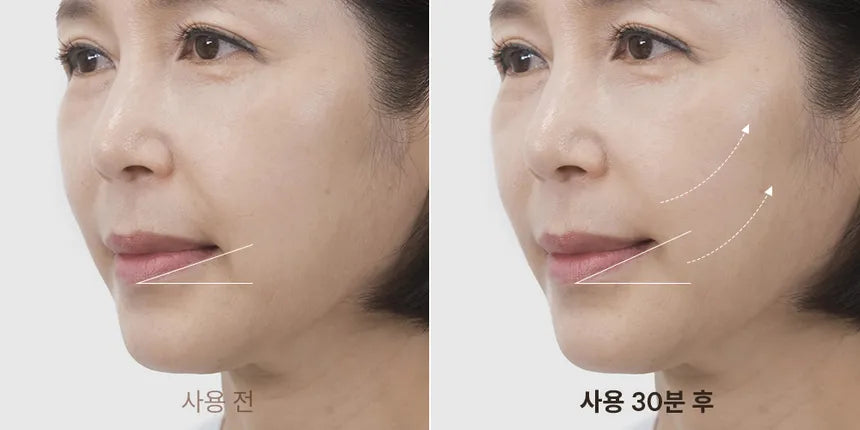 [MARSHIQUE] Line Lifting Hydrogel Smile Line Patch [6pcs]