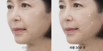 [MARSHIQUE] Line Lifting Hydrogel Smile Line Patch [6pcs]