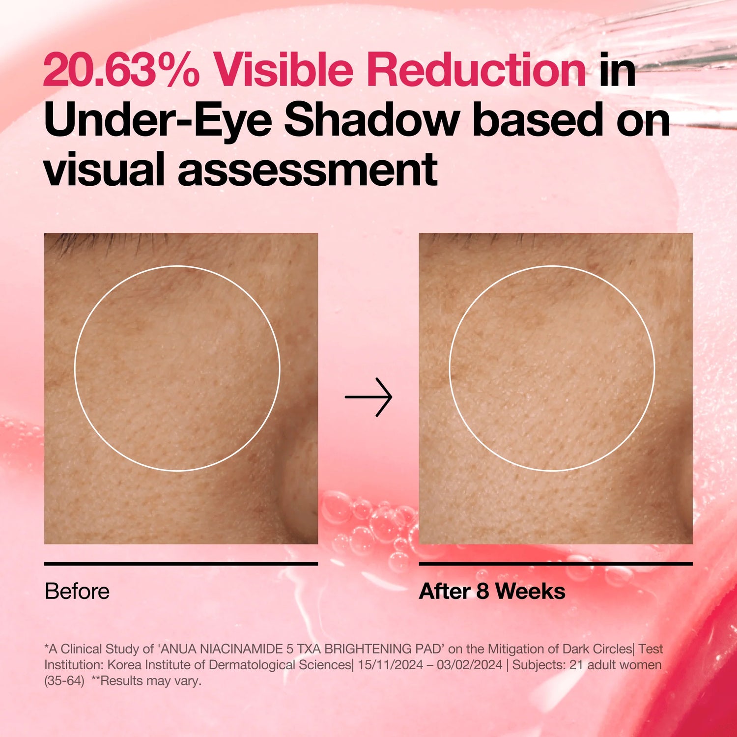 Niacinamide 5 TXA Brightening Pad [60 Pads]