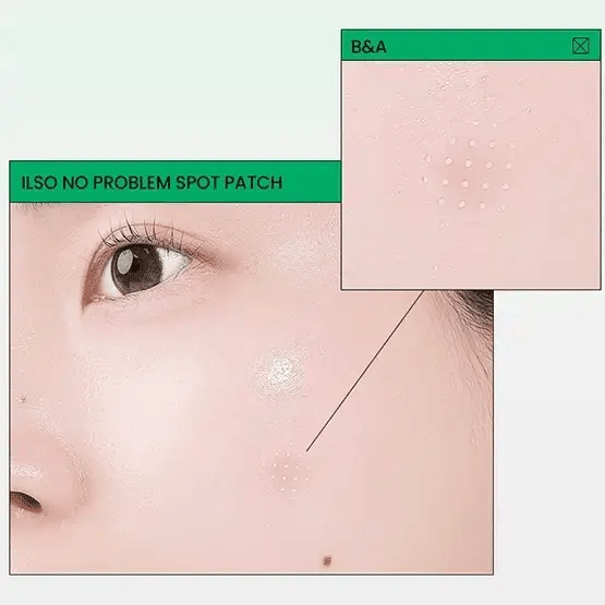 No Problem Spot Patch [1pc / 72 Patches]