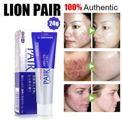 [LION] Pair Acne Cream W [24g] - Treatment