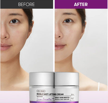 [VT] Reedle Shot Lifting Cream [50ml] - Skincare